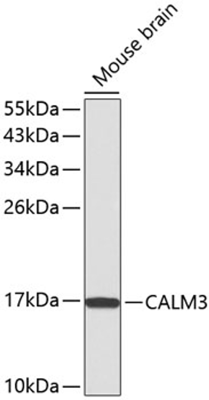 Western blot analysis of extracts of Mouse brain using CALM3 Polyclonal Antibody.