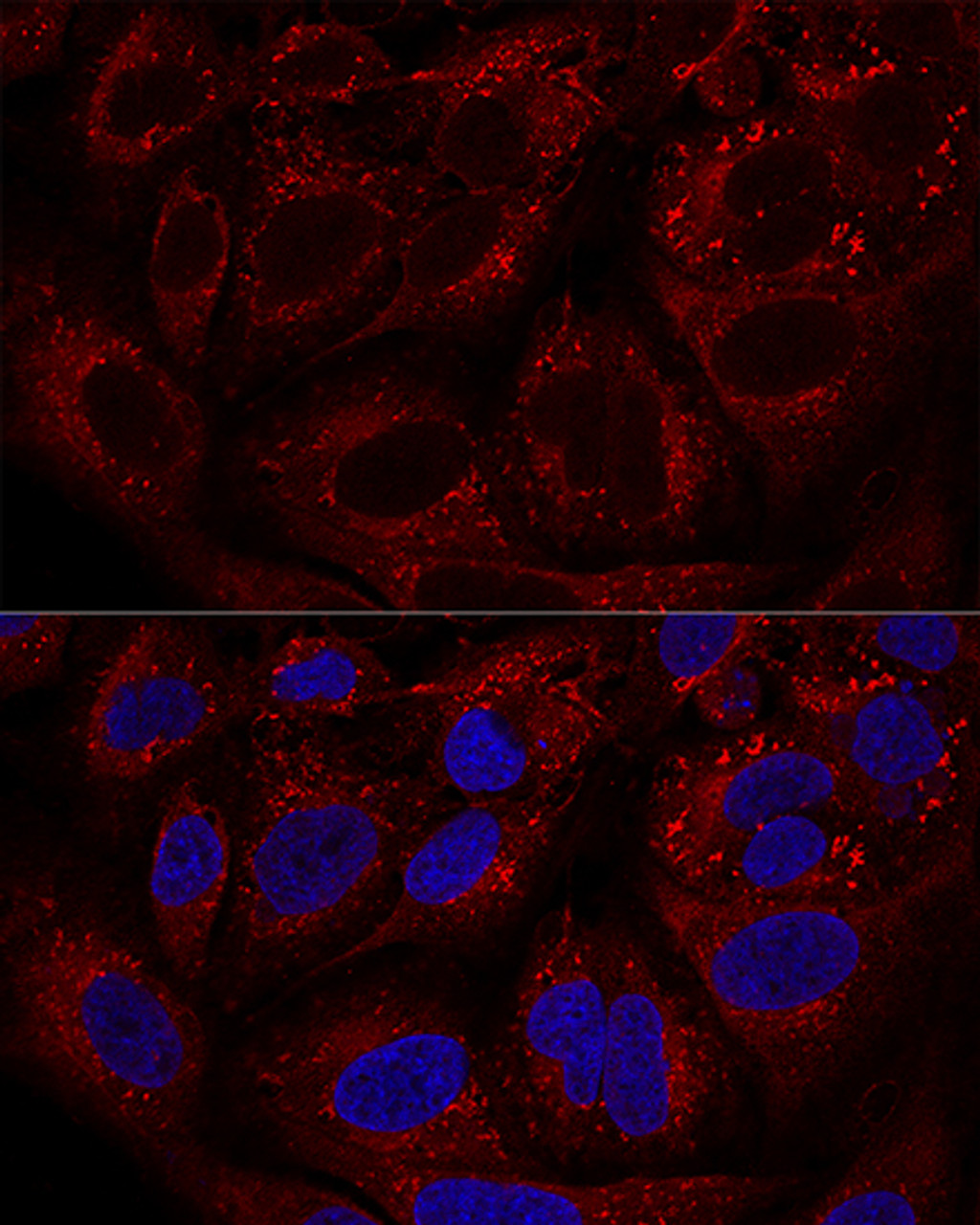 Confocal immunofluorescence analysis of U2OS cells using LAMTOR1 Polyclonal Antibody at dilution of  1:100. Blue: DAPI for nuclear staining.