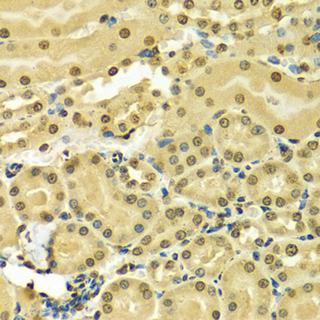 Immunohistochemistry of paraffin-embedded Mouse kidney using HNRNPA2B1 Polyclonal Antibody at dilution of  1:100 (40x lens).