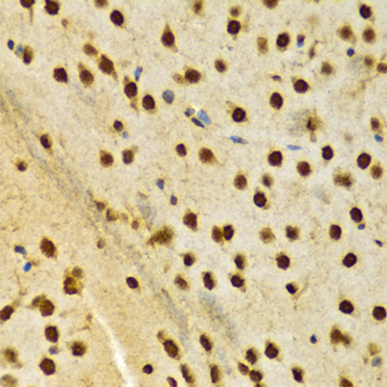 Immunohistochemistry of paraffin-embedded Rat brain using HNRNPA2B1 Polyclonal Antibody at dilution of  1:100 (40x lens).