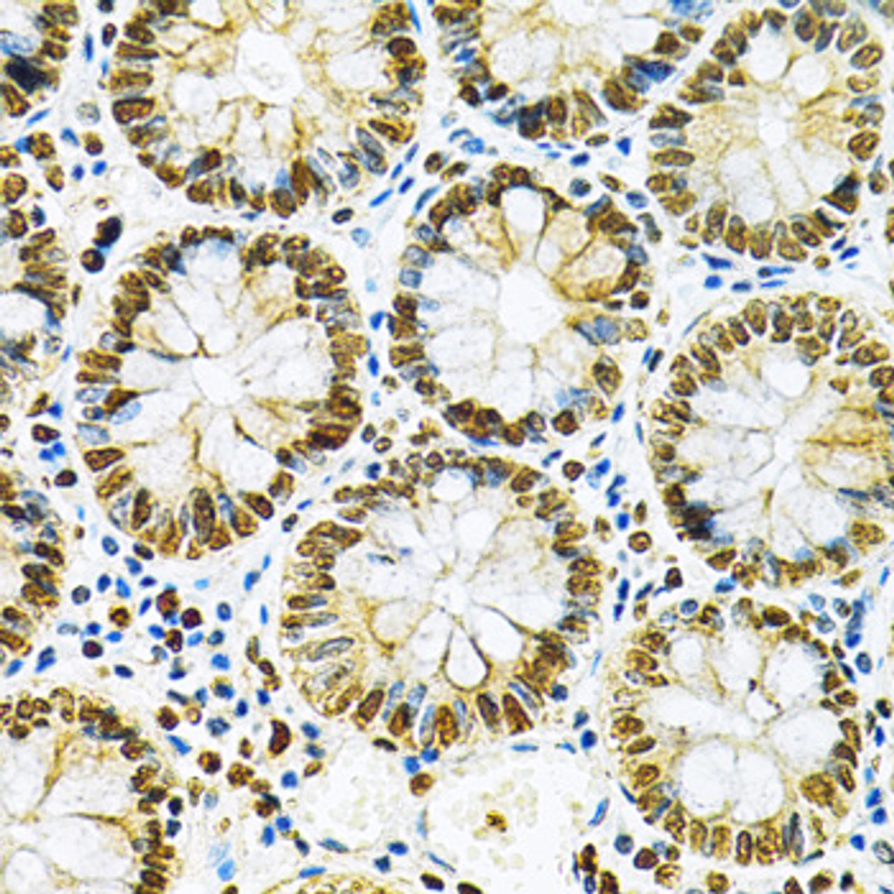 Immunohistochemistry of paraffin-embedded Human colon using HNRNPA2B1 Polyclonal Antibody at dilution of  1:200 (40x lens).