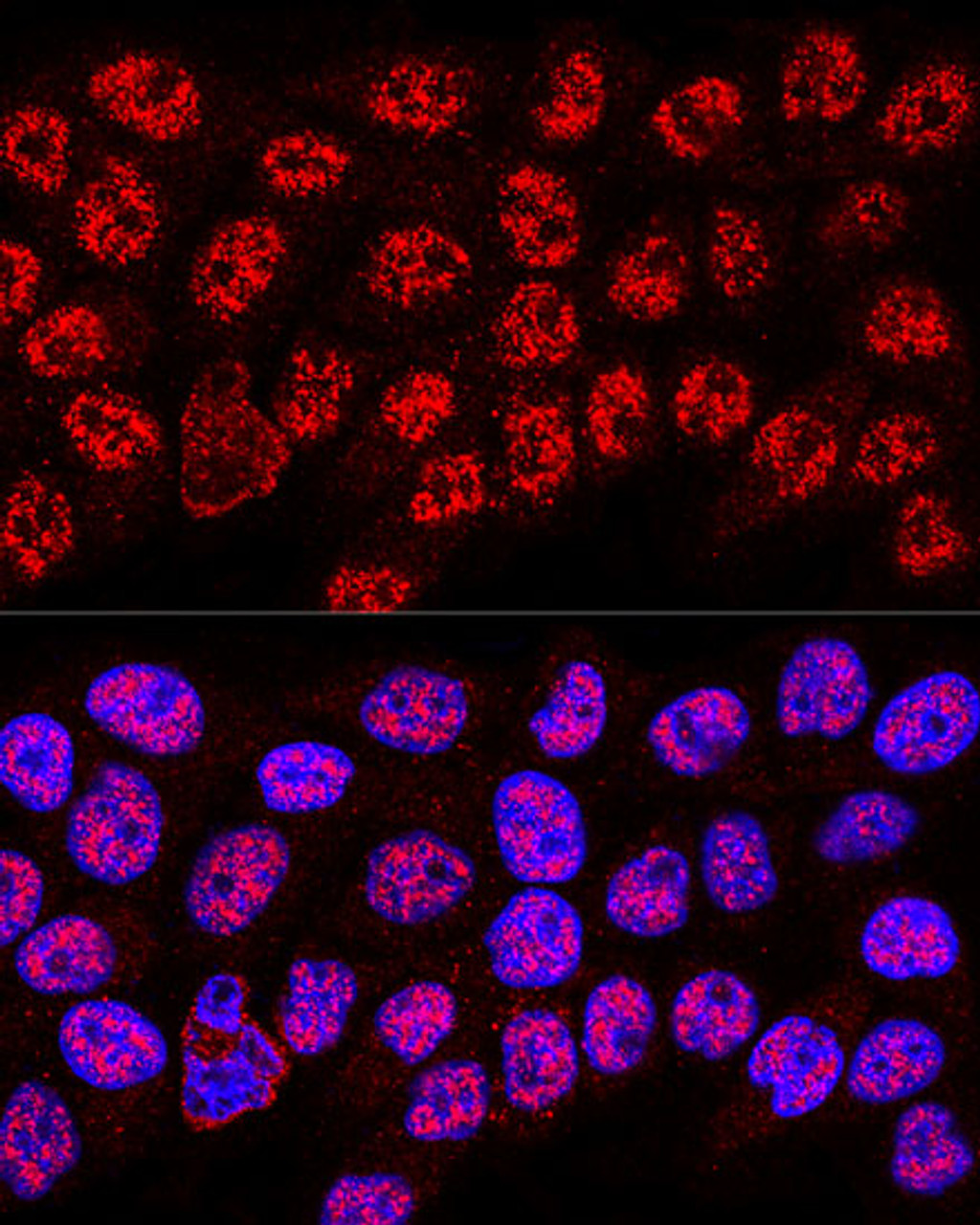 Confocal immunofluorescence analysis of HeLa cells using HNRNPA2B1 Polyclonal Antibody at dilution of  1:400. Blue: DAPI for nuclear staining.