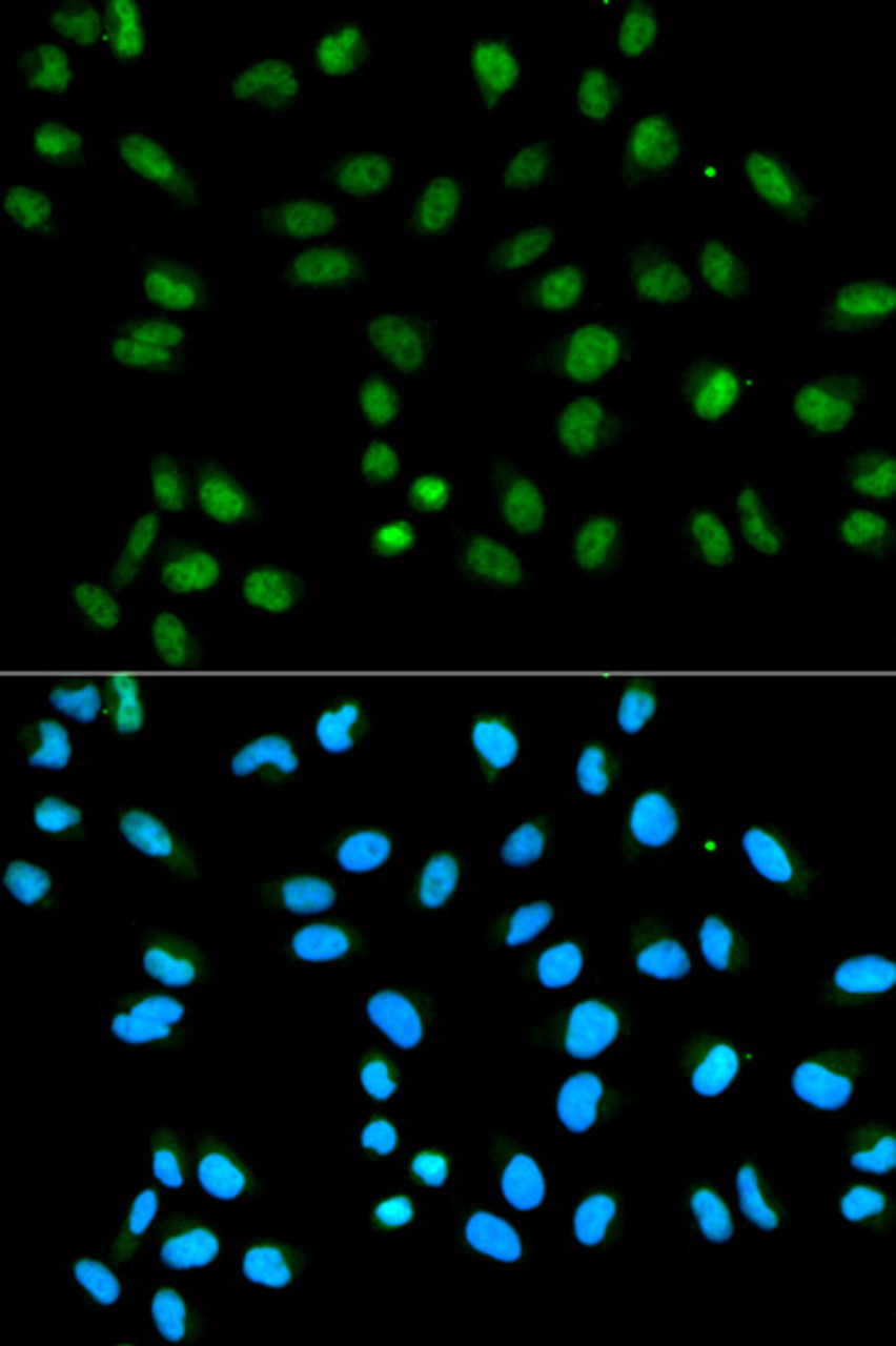 Immunofluorescence analysis of HeLa cells using HNRNPA2B1 Polyclonal Antibody