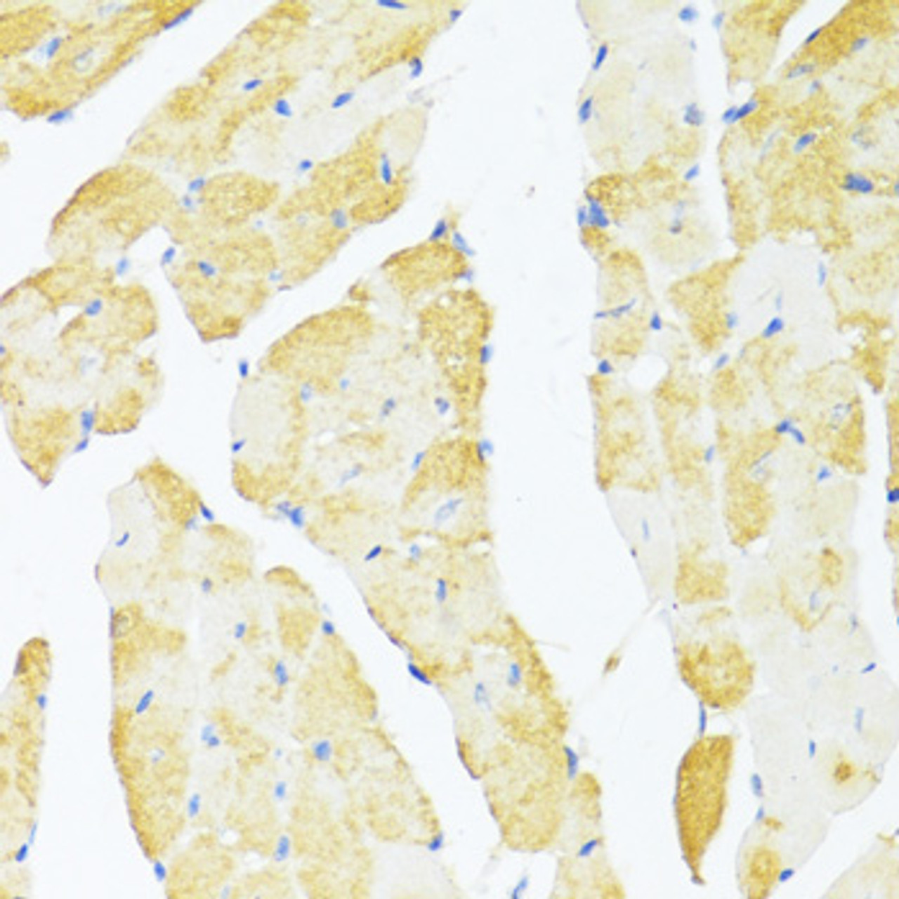 Immunohistochemistry of paraffin-embedded Mouse heart using DDX3Y Polyclonal Antibody at dilution of  1:100 (40x lens).