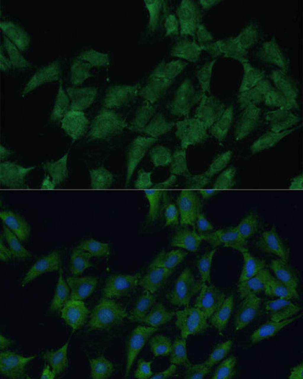 Immunofluorescence analysis of C6 cells using DDX3Y Polyclonal Antibody at dilution of  1:100 (40x lens). Blue: DAPI for nuclear staining.