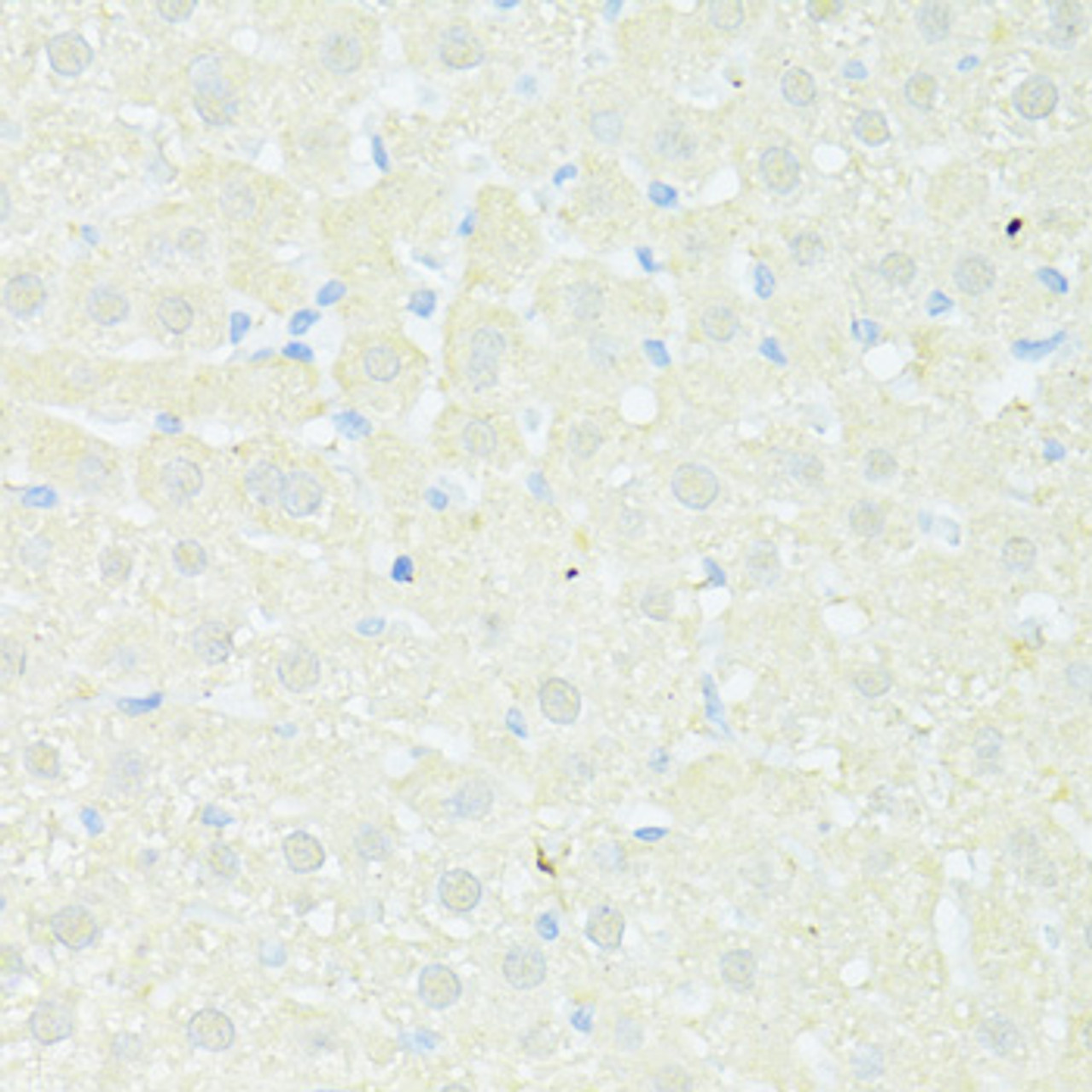 Immunohistochemistry of paraffin-embedded Rat liver using TRIM15 Polyclonal Antibody at dilution of  1:100 (40x lens).