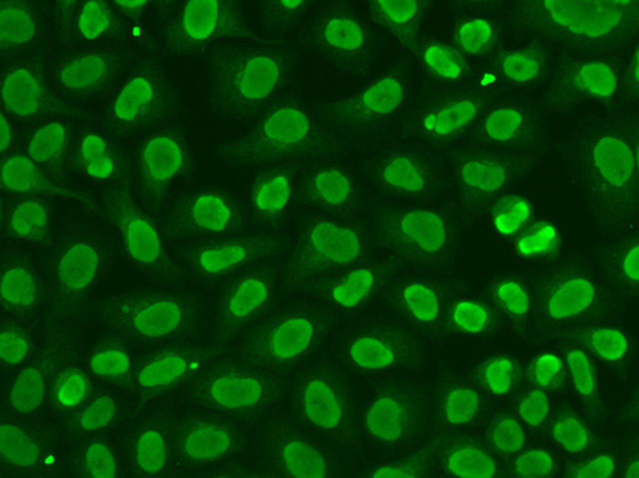 Immunofluorescence analysis of HeLa cells using FEN1 Polyclonal Antibody
