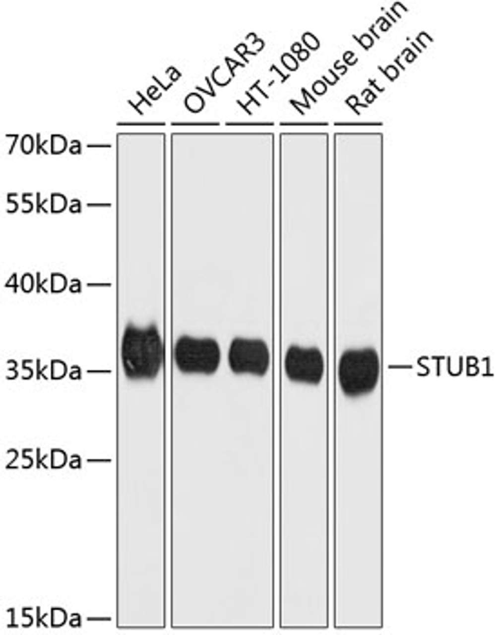 Western blot analysis of extracts of various cell lines using STUB1 Polyclonal Antibody at dilution of 1:1000.