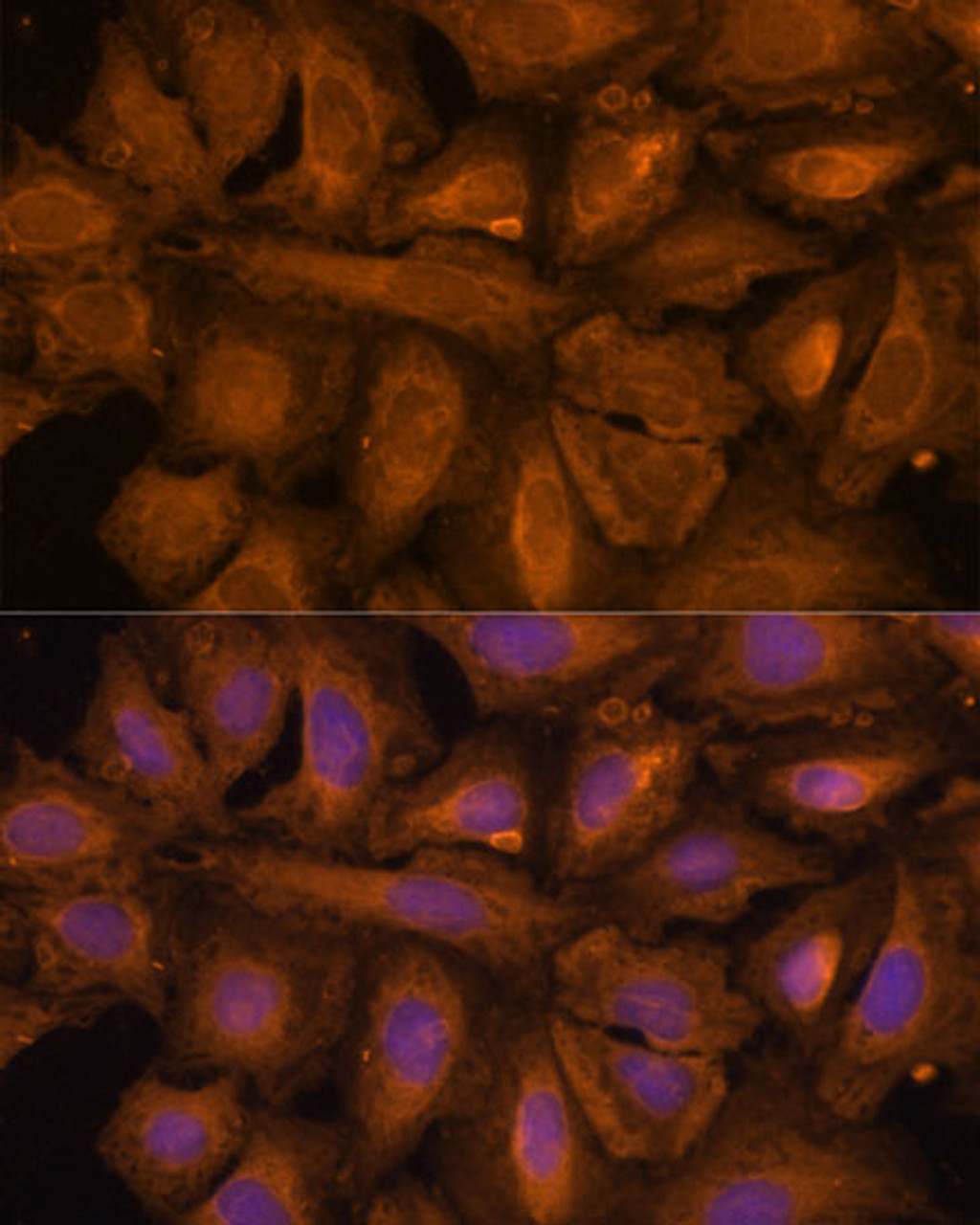 Immunofluorescence analysis of U-2 OS cells using STUB1 Polyclonal Antibody at dilution of  1:100 (40x lens). Blue: DAPI for nuclear staining.