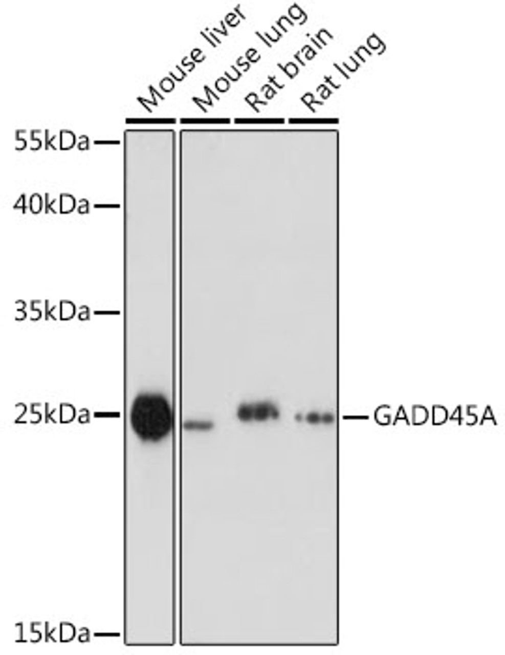 Western blot analysis of extracts of various cell lines using GADD45A Polyclonal Antibody at dilution of 1:1000.