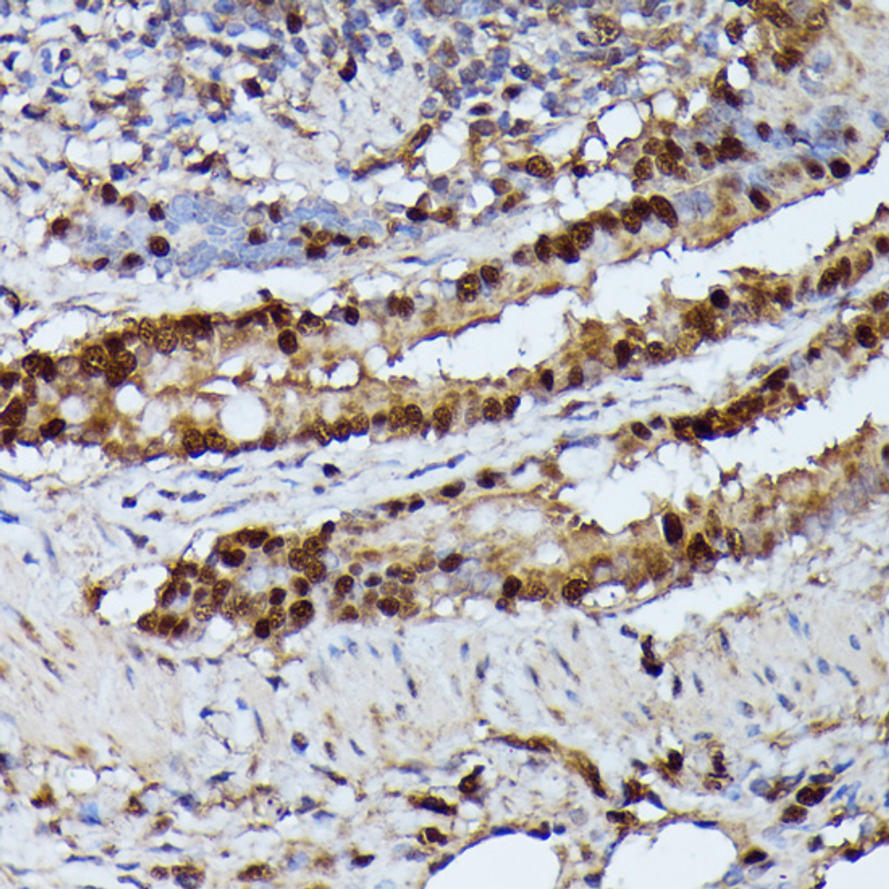 Immunohistochemistry of paraffin-embedded Rat lung using GADD45A Polyclonal Antibody at dilution of  1:100 (40x lens).
