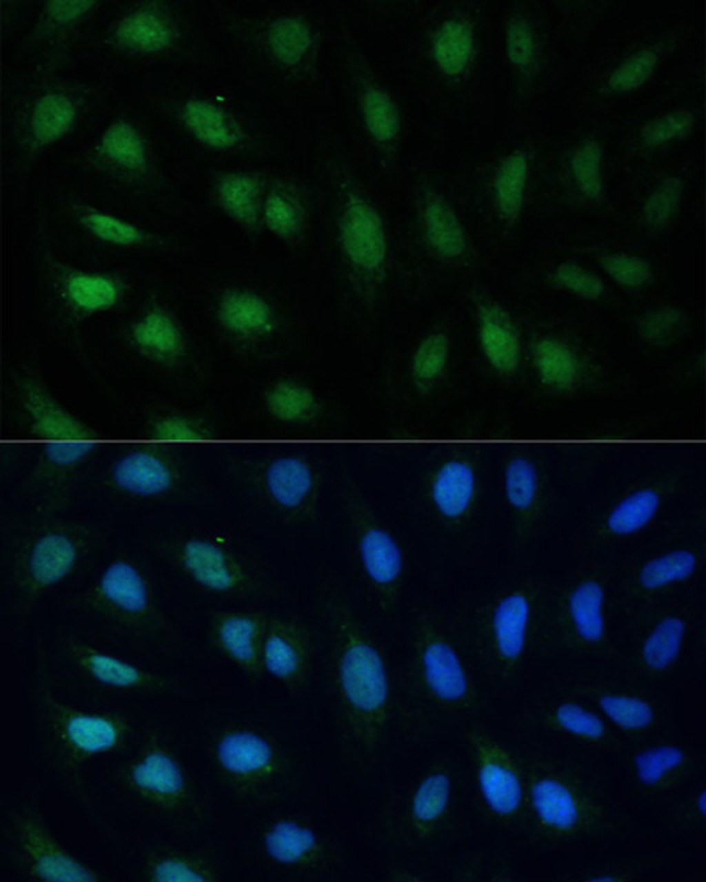 Immunofluorescence analysis of U2OS cells using GADD45A Polyclonal Antibody at dilution of  1:100. Blue: DAPI for nuclear staining.