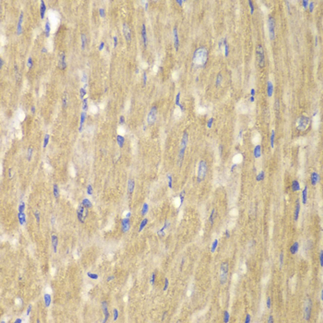 Immunohistochemistry of paraffin-embedded Mouse heart using NOXA2 / P67phox Polyclonal Antibody at dilution of  1:100 (40x lens).