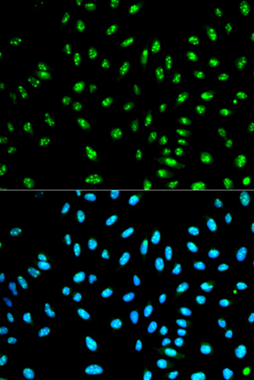 Immunofluorescence analysis of HeLa cells using NOXA2 / P67phox Polyclonal Antibody