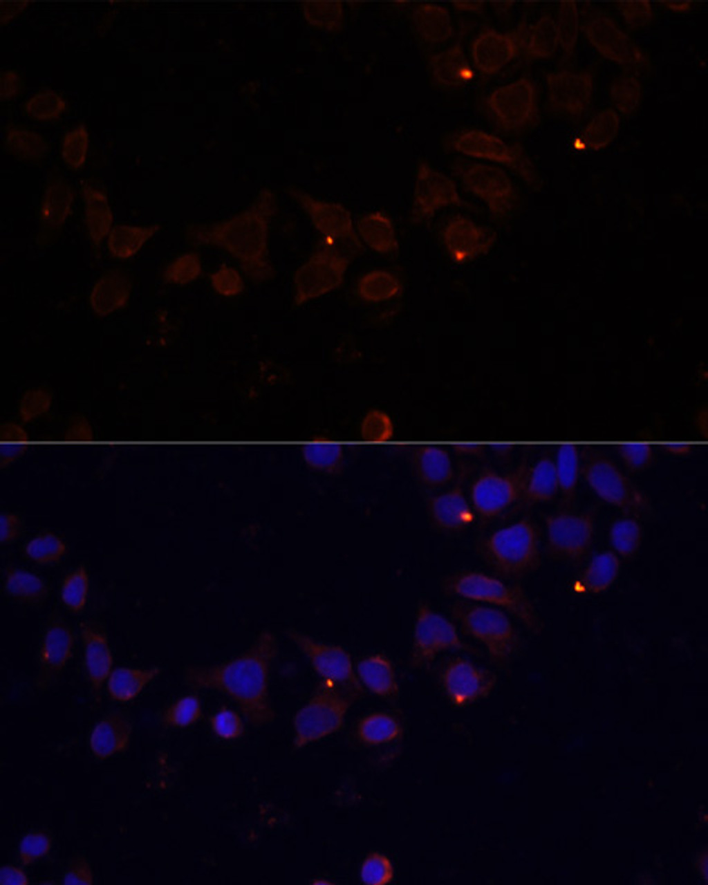 Immunofluorescence analysis of 293T cells using FXN / FRataxin Polyclonal Antibody at dilution of  1:100 (40x lens). Blue: DAPI for nuclear staining.