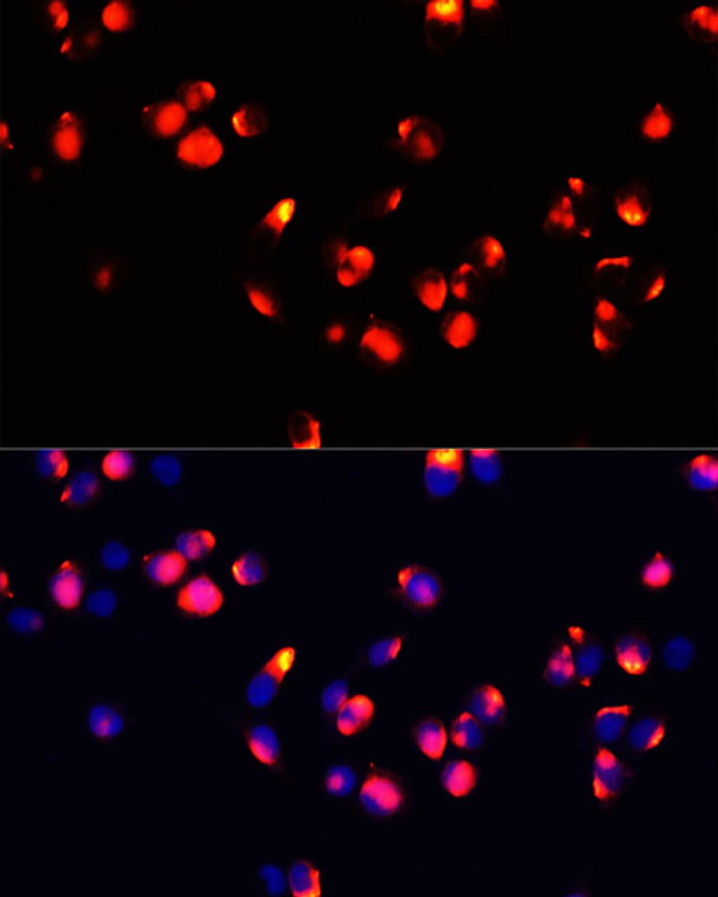 Immunofluorescence analysis of HeLa cells using FXN / FRataxin Polyclonal Antibody at dilution of  1:100 (40x lens). Blue: DAPI for nuclear staining.