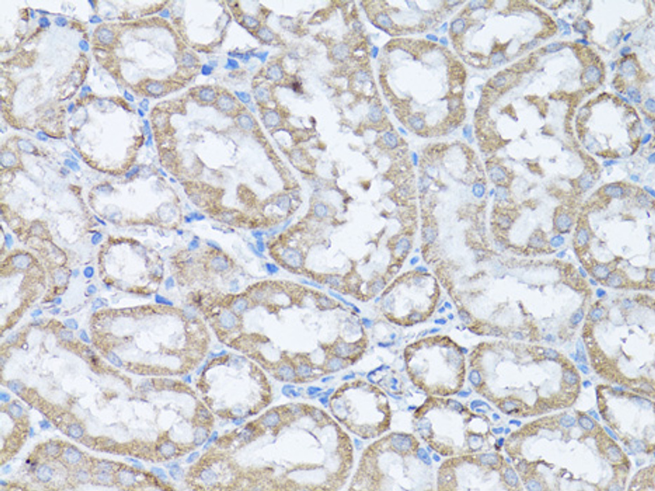 Immunohistochemistry of paraffin-embedded Rat kidney using Snail Polyclonal Antibody at dilution of  1:100 (40x lens).