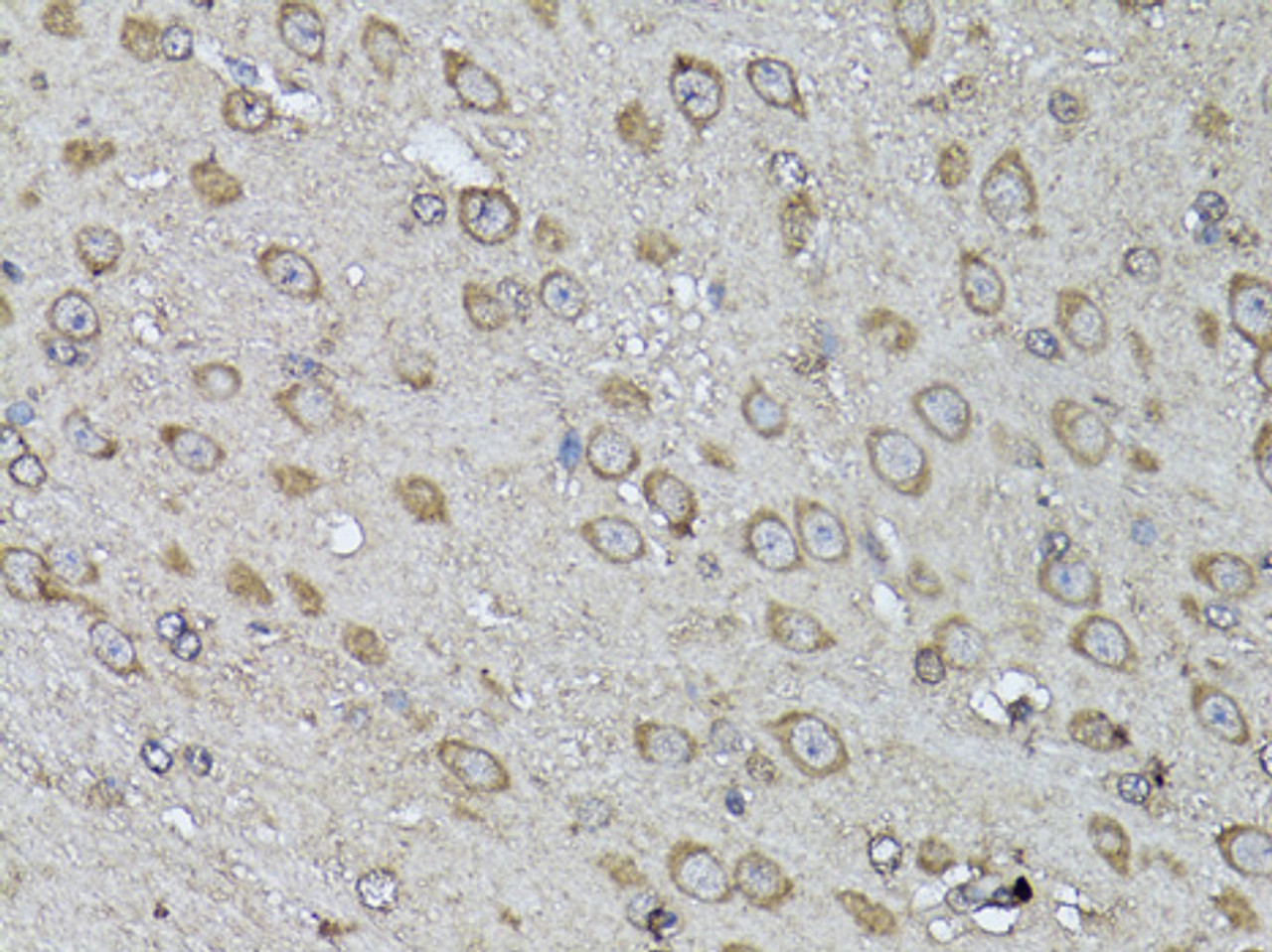 Immunohistochemistry of paraffin-embedded Mouse brain using Snail Polyclonal Antibody at dilution of  1:100 (40x lens).