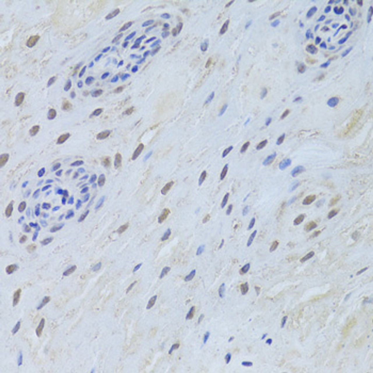 Immunohistochemistry of paraffin-embedded Human esophagus using TARDBP Polyclonal Antibody at dilution of  1:200 (40x lens).