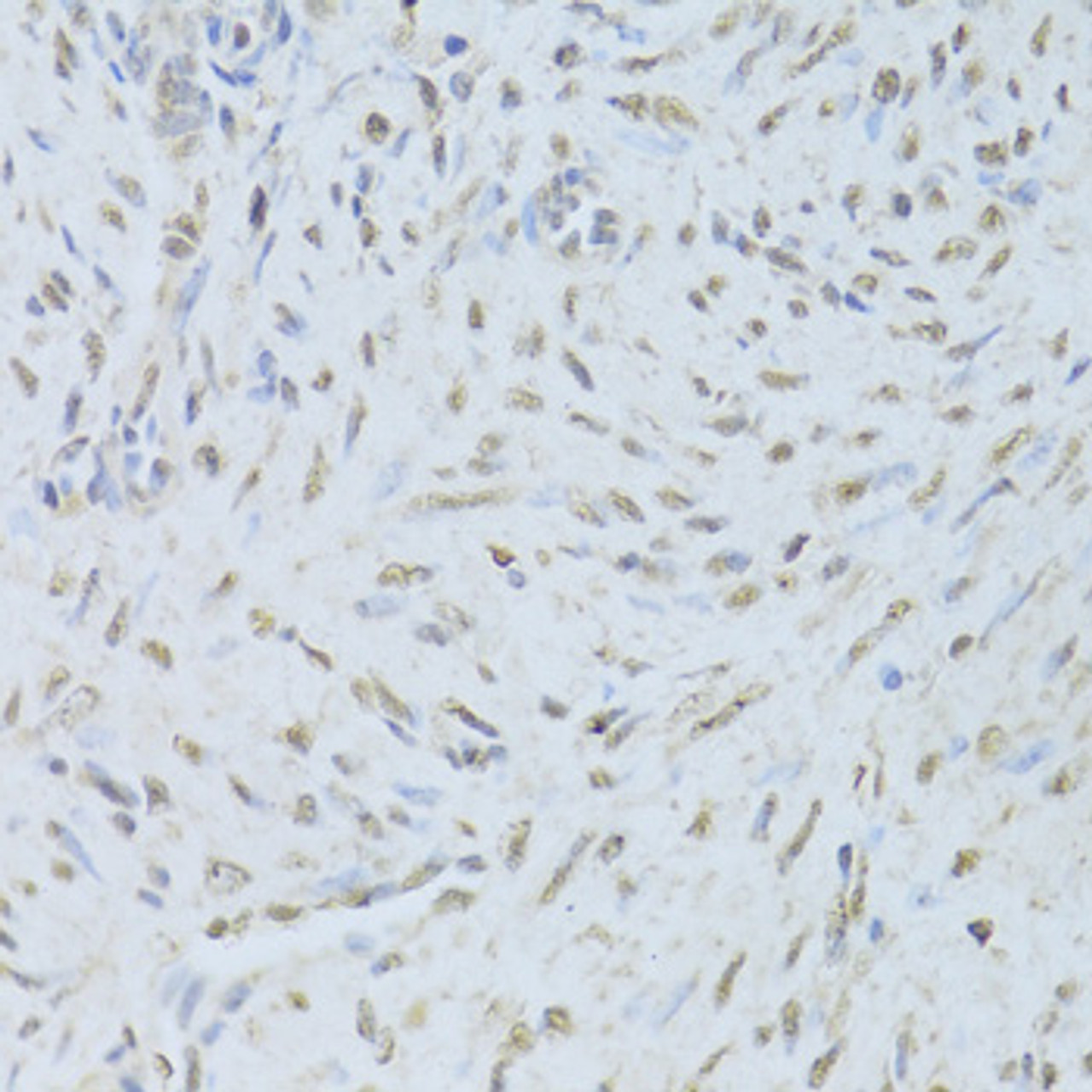 Immunohistochemistry of paraffin-embedded Human endometrium using TARDBP Polyclonal Antibody at dilution of  1:200 (40x lens).