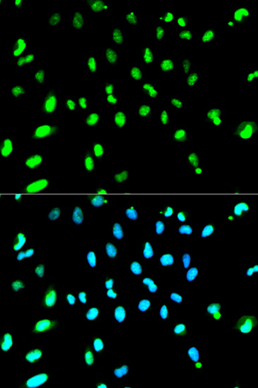 Immunofluorescence analysis of HeLa cells using TARDBP Polyclonal Antibody