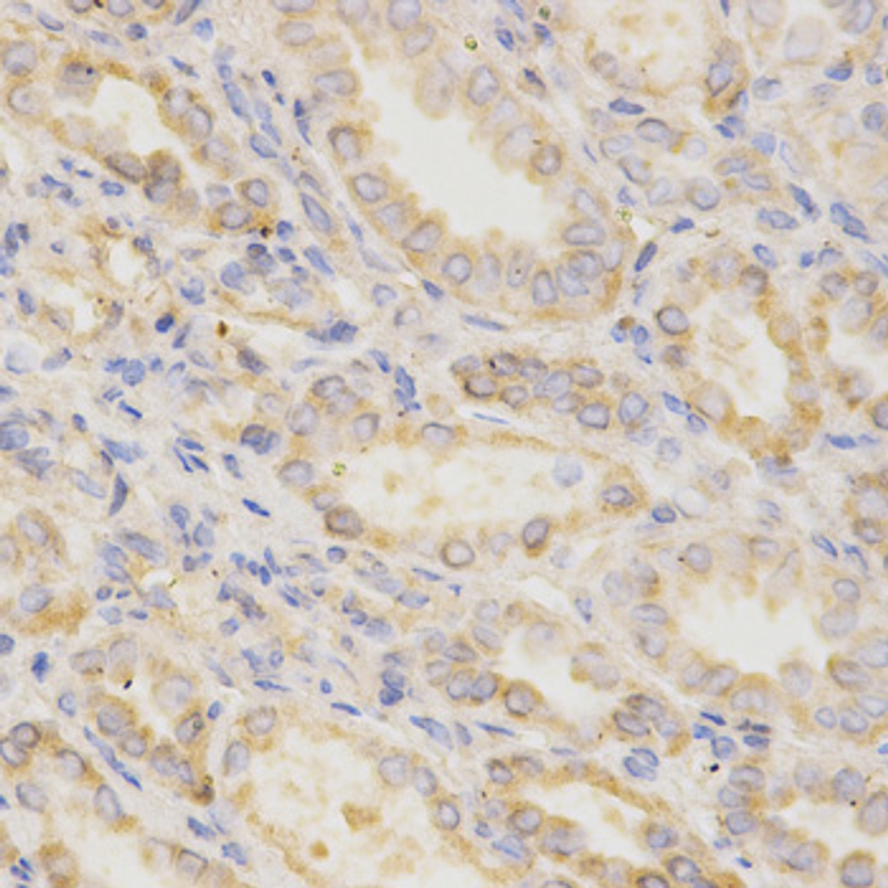 Immunohistochemistry of paraffin-embedded Human kidney using GGA2 Polyclonal Antibody at dilution of  1:200 (40x lens).