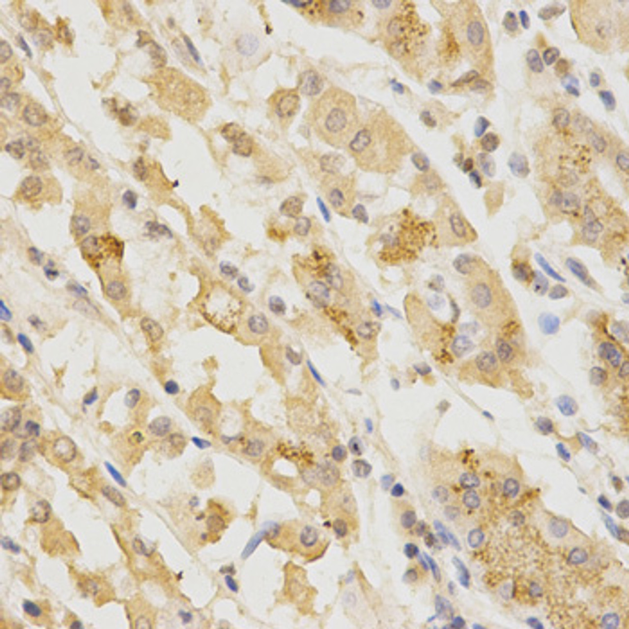 Immunohistochemistry of paraffin-embedded Human stomach using GGA2 Polyclonal Antibody at dilution of  1:200 (40x lens).