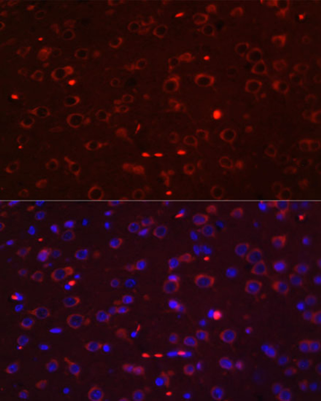 Immunofluorescence analysis of Rat brain using STAT3 Polyclonal Antibody at dilution of  1:100. Blue: DAPI for nuclear staining.