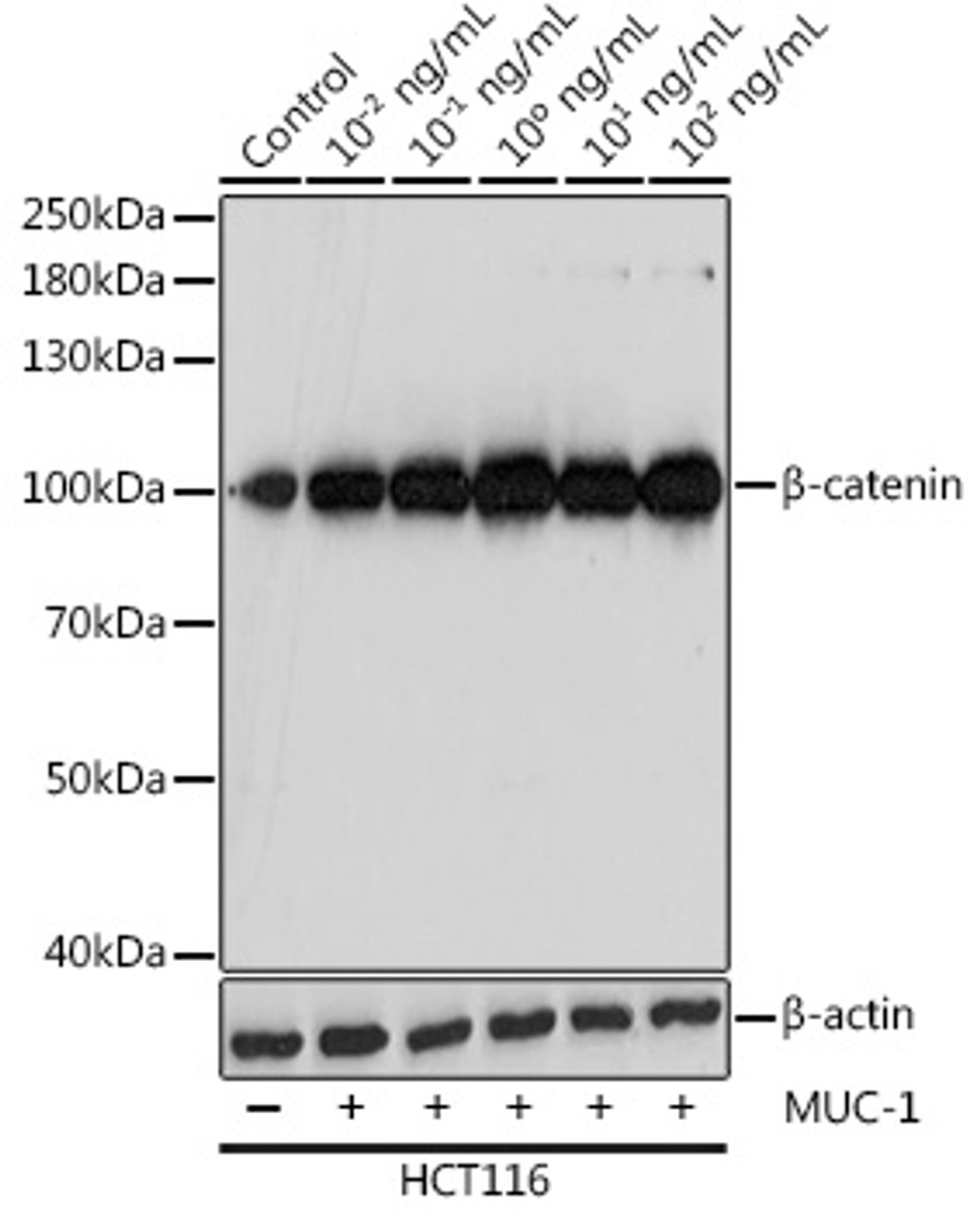 Western blot analysis of extracts of HCT116 cells using β-catenin Polyclonal Antibody at dilution of 1:1000.
