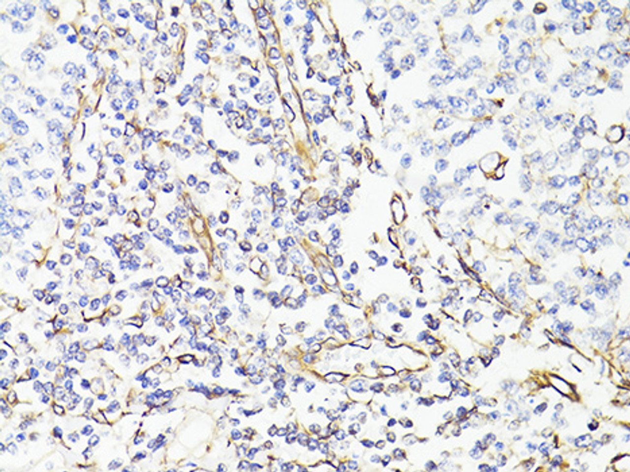 Immunohistochemistry of paraffin-embedded Human tonsil using Vimentin Polyclonal Antibody at dilution of  1:150 (40x lens).