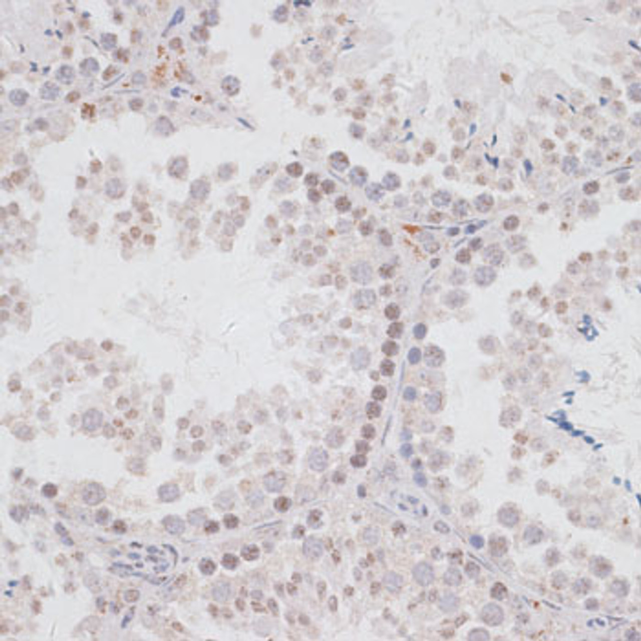 Immunohistochemistry of paraffin-embedded Mouse testis using KDM3A Polyclonal Antibody at dilution of  1:100 (40x lens).