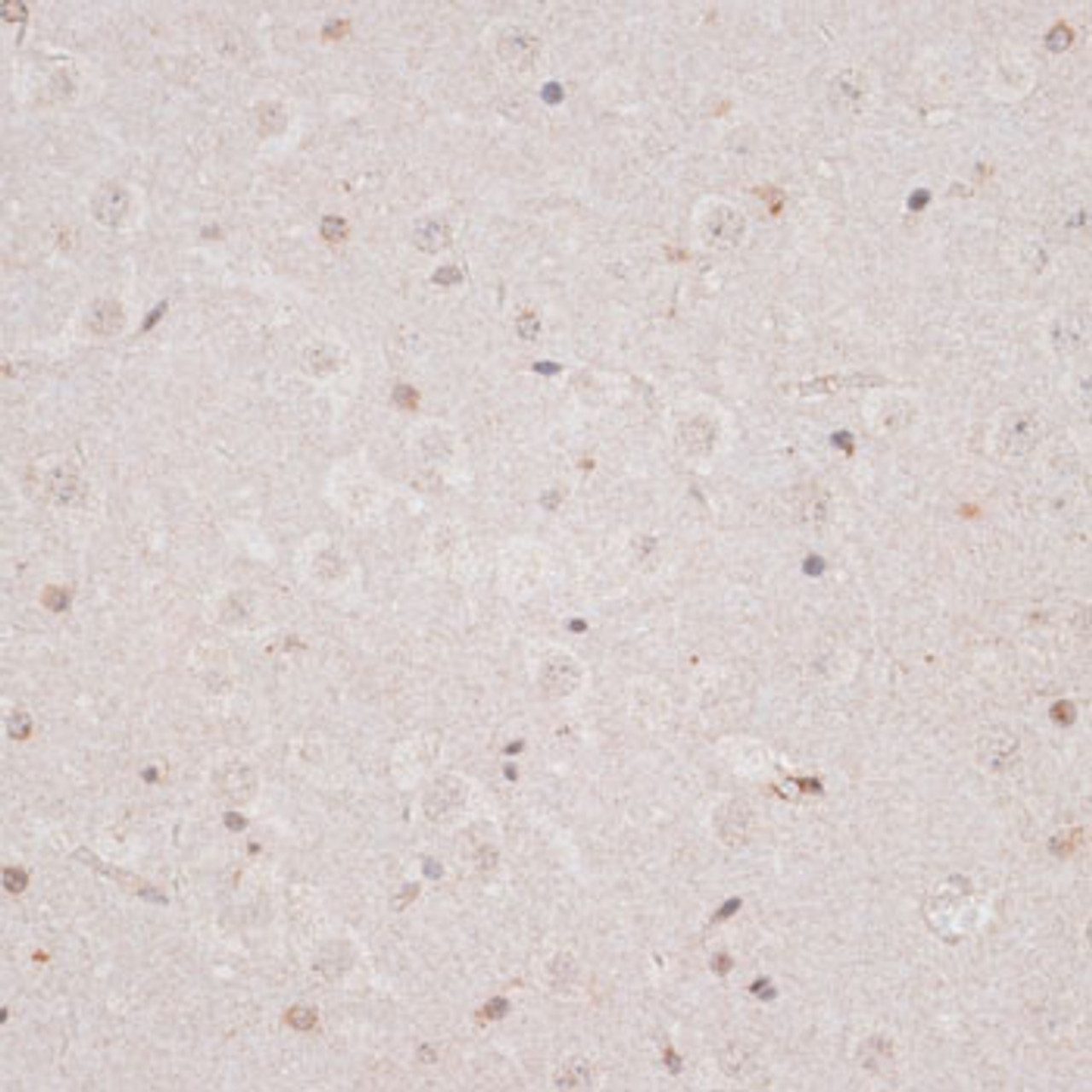 Immunohistochemistry of paraffin-embedded Mouse brain using KDM3A Polyclonal Antibody at dilution of  1:100 (40x lens).