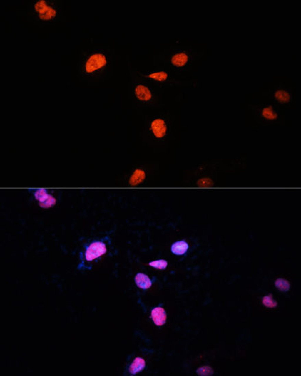 Immunofluorescence analysis of U-2 OS cells using KDM3A Polyclonal Antibody at dilution of  1:100 (40x lens). Blue: DAPI for nuclear staining.