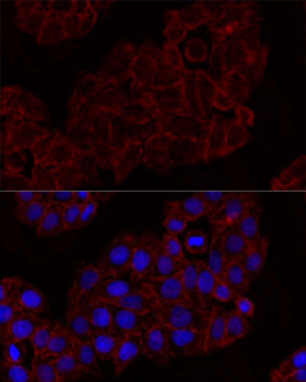 Immunofluorescence analysis of HeLa cells using KLRK1 Polyclonal Antibody at dilution of  1:100. Blue: DAPI for nuclear staining.