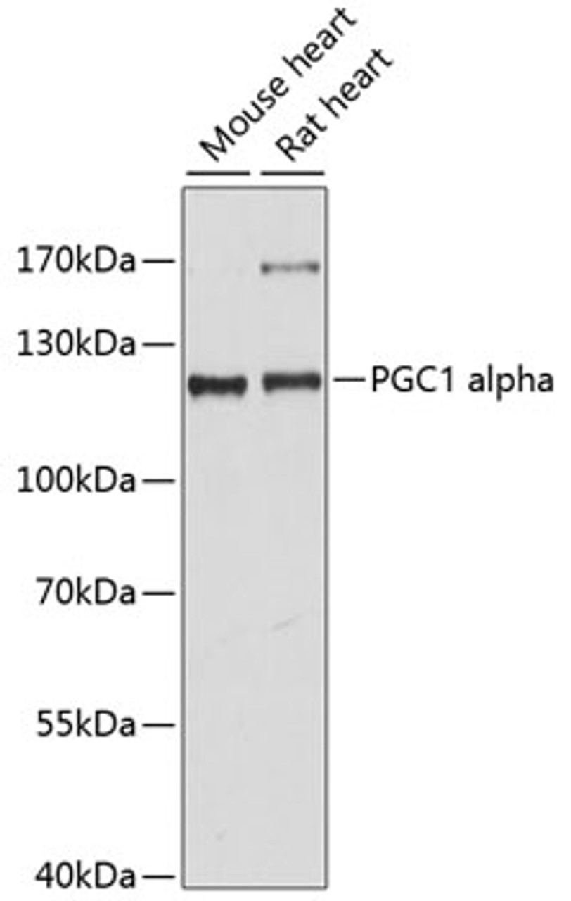 Western blot analysis of extracts of various cell lines using PGC1 alpha Polyclonal Antibody at dilution of 1:1000.