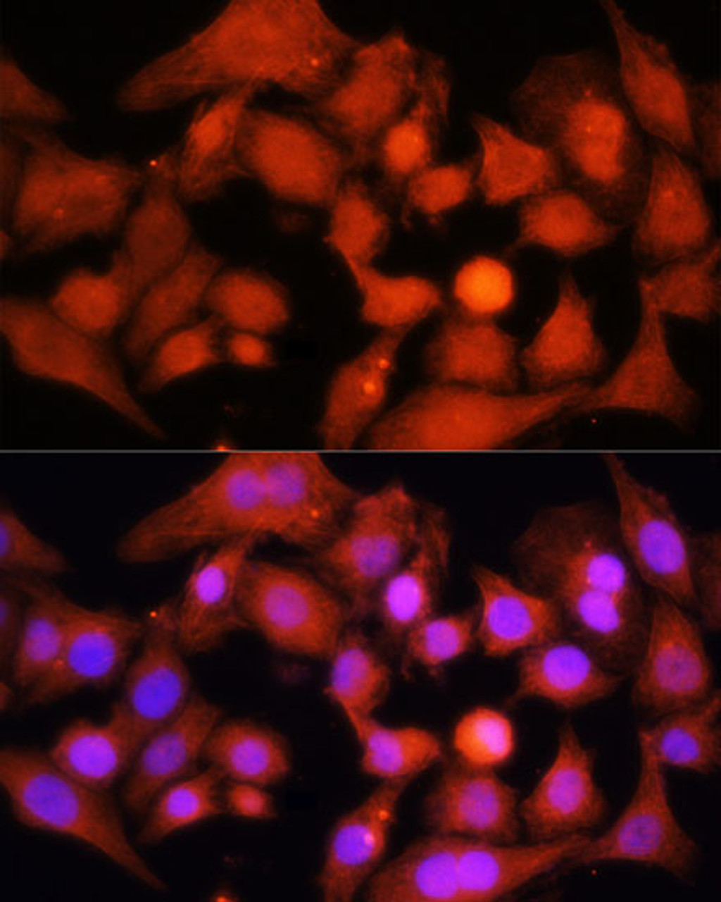 Immunofluorescence analysis of HeLa cells using PGC1 alpha Polyclonal Antibody at dilution of  1:100. Blue: DAPI for nuclear staining.