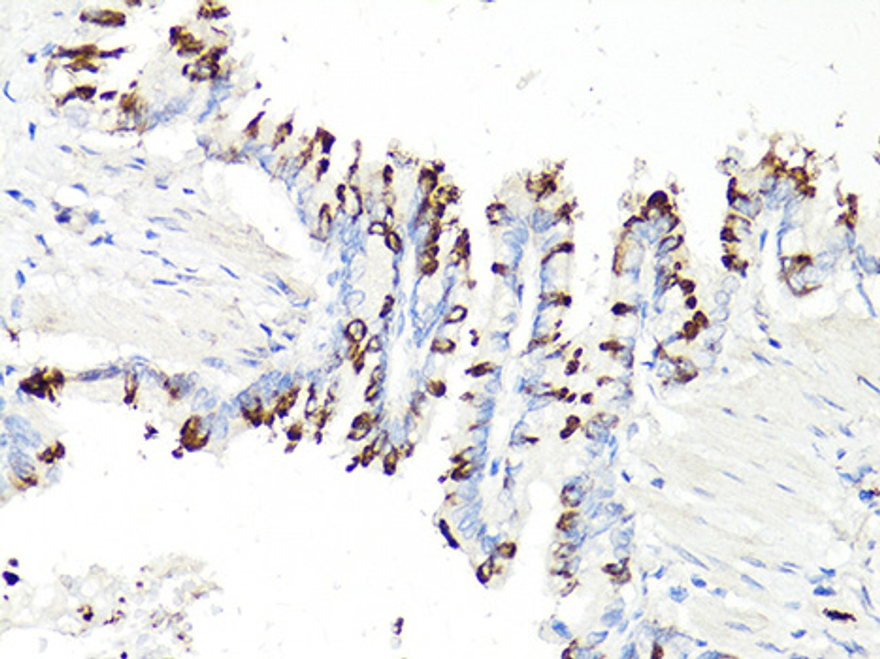 Immunohistochemistry of paraffin-embedded Rat bronchial epithelium using PD-1 Polyclonal Antibody at dilution of  1:100 (40x lens).