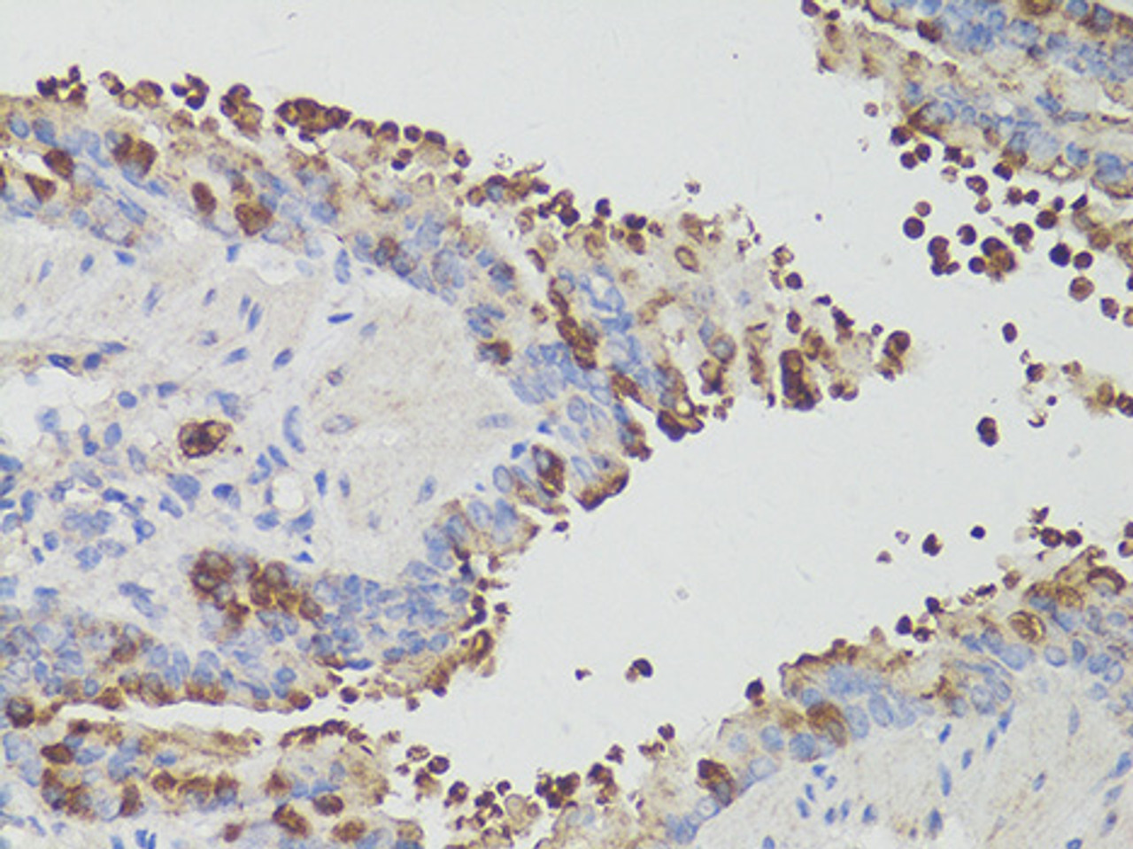 Immunohistochemistry of paraffin-embedded Mouse bronchial epithelium using PD-1 Polyclonal Antibody at dilution of  1:200 (40x lens).