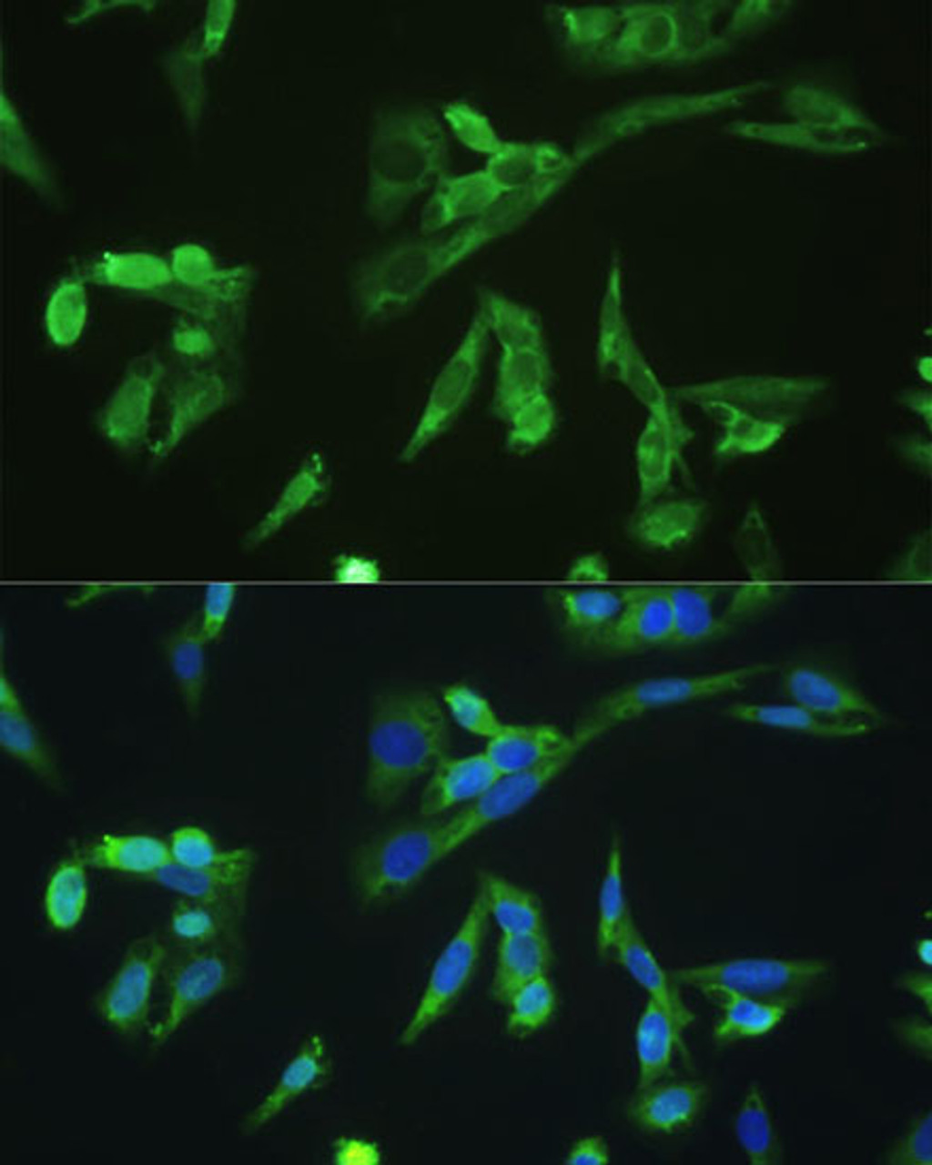 Immunofluorescence analysis of U2OS cells using PD-1 Polyclonal Antibody at dilution of  1:100. Blue: DAPI for nuclear staining.