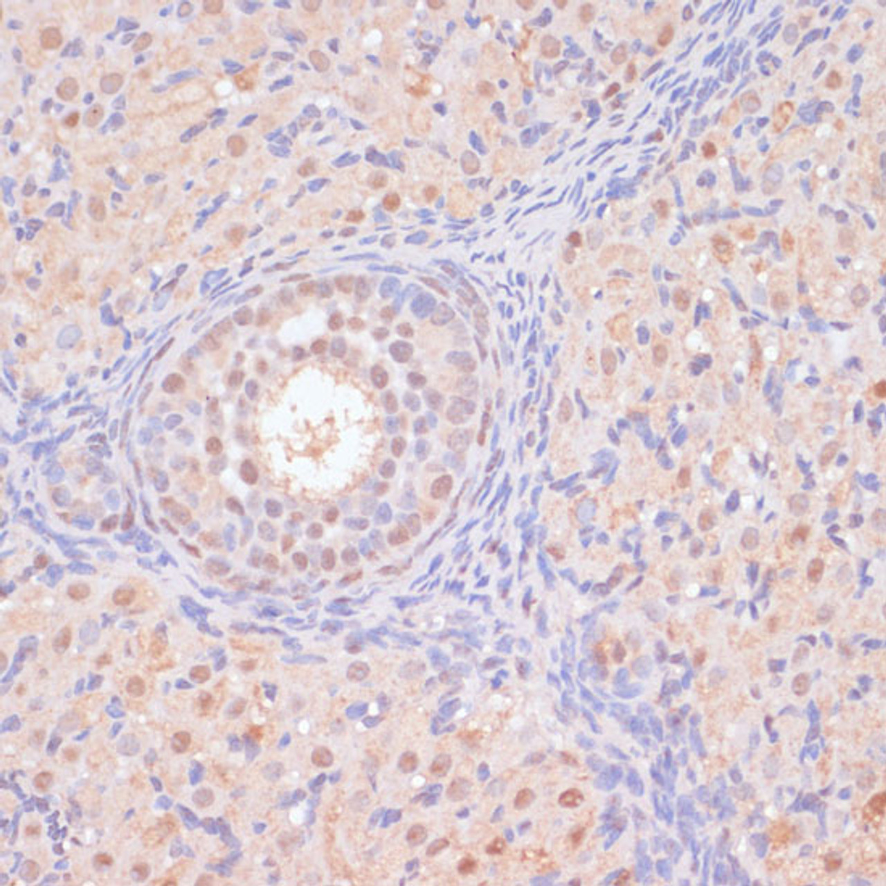 Immunohistochemistry of paraffin-embedded Rat ovary using BYSL Polyclonal Antibody at dilution of  1:100 (40x lens).