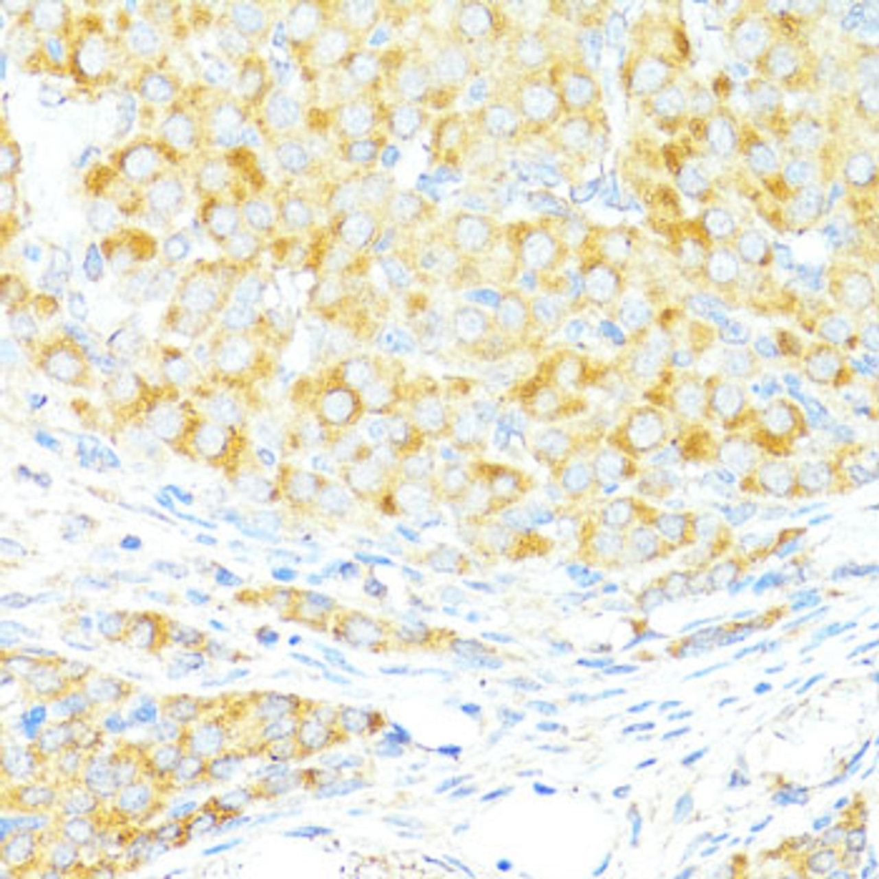 Immunohistochemistry of paraffin-embedded Rat ovary using BAX Polyclonal Antibody at dilution of  1:100 (40x lens).