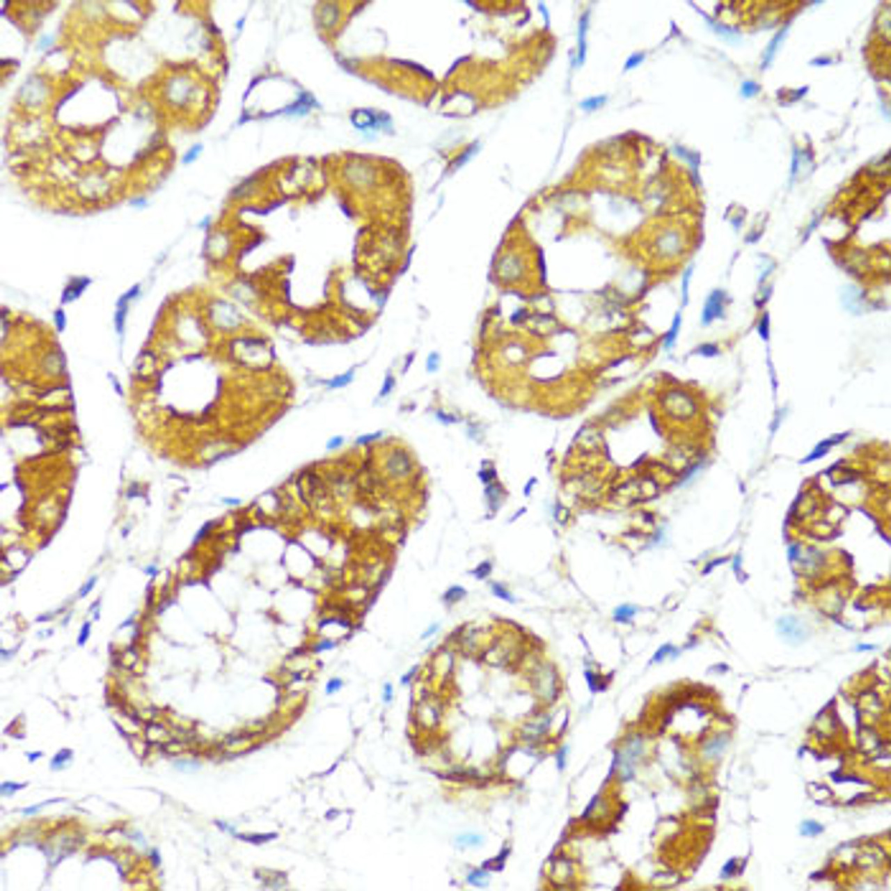 Immunohistochemistry of paraffin-embedded Human stomach using BAX Polyclonal Antibody at dilution of  1:100 (40x lens).
