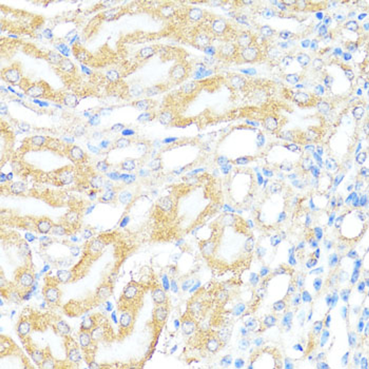 Immunohistochemistry of paraffin-embedded Mouse kidney using BAX Polyclonal Antibody at dilution of  1:100 (40x lens).