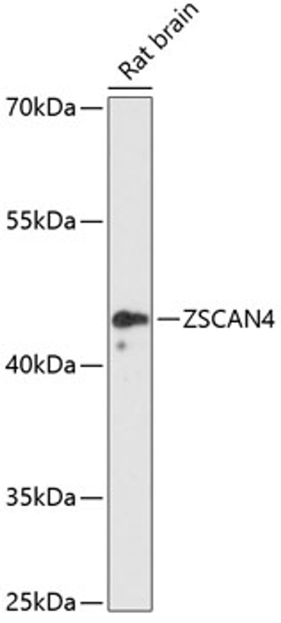 Western blot analysis of extracts of Rat brain using ZSCAN4 Polyclonal Antibody at dilution of 1:3000.
