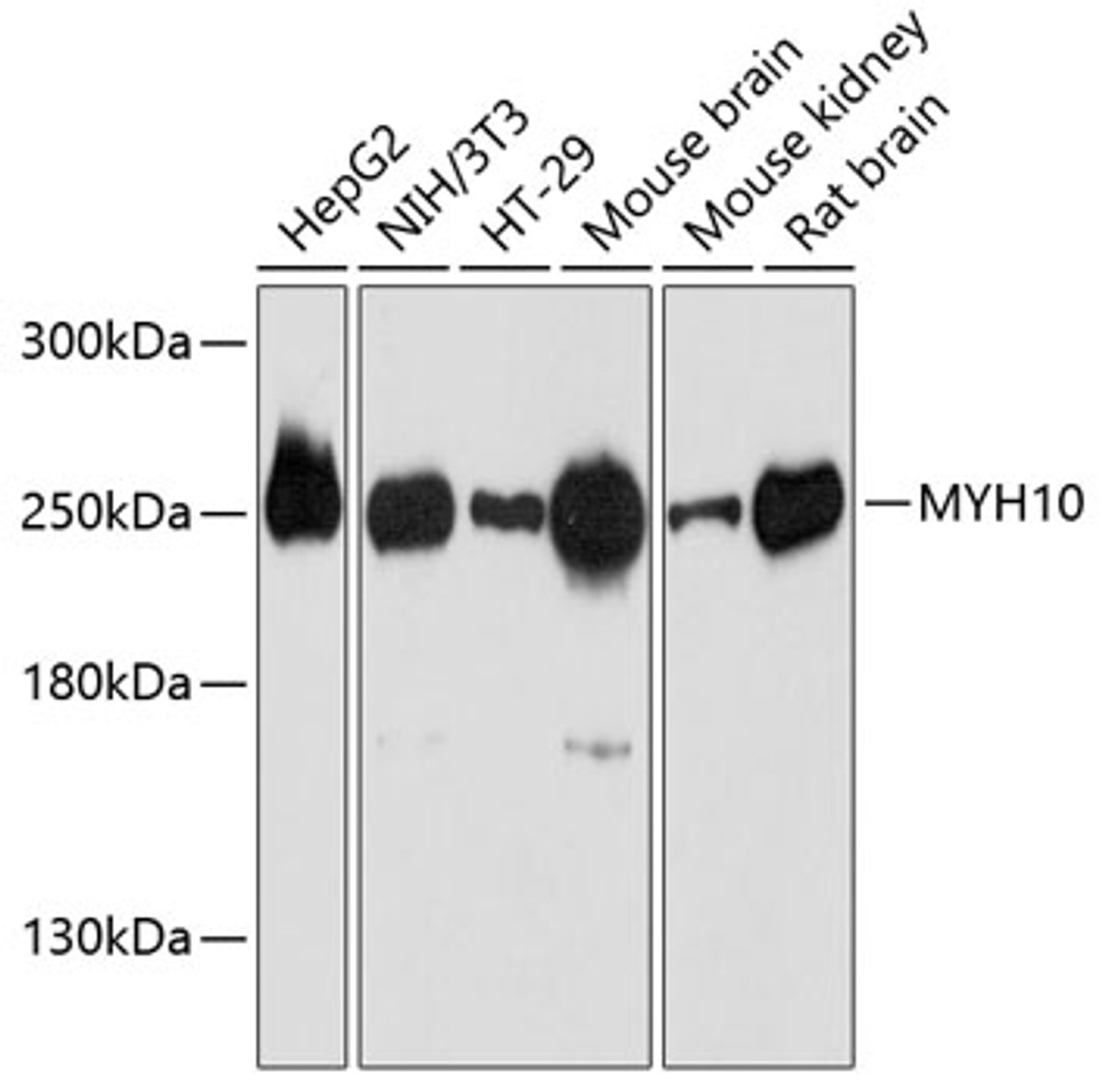Western blot analysis of extracts of various cell lines using MYH10 Polyclonal Antibody at dilution of 1:3000.