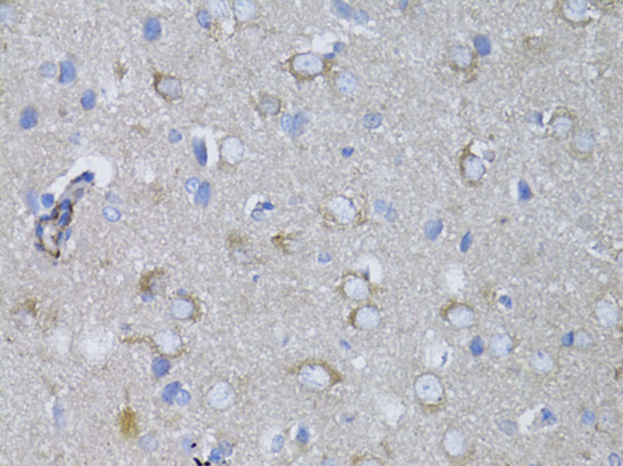 Immunohistochemistry of paraffin-embedded Rat brain using MYH10 Polyclonal Antibody at dilution of  1:100 (40x lens).
