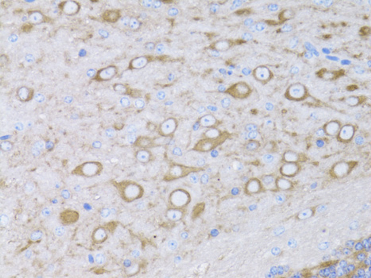 Immunohistochemistry of paraffin-embedded Mouse brain using MYH10 Polyclonal Antibody at dilution of  1:100 (40x lens).