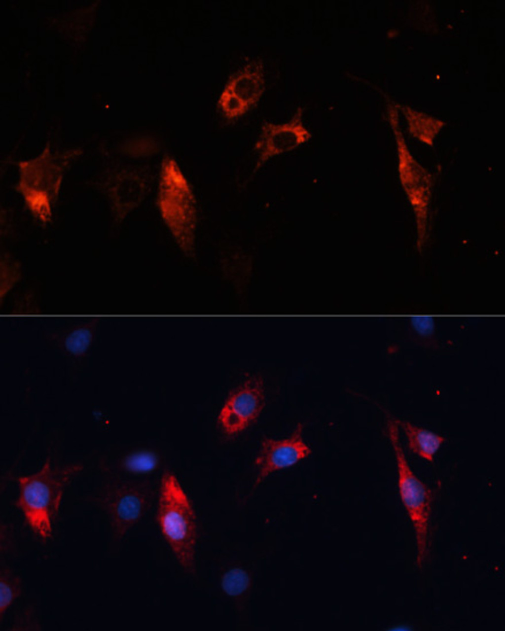 Immunofluorescence analysis of C6 cells using CTSL Polyclonal Antibody at dilution of  1:100. Blue: DAPI for nuclear staining.