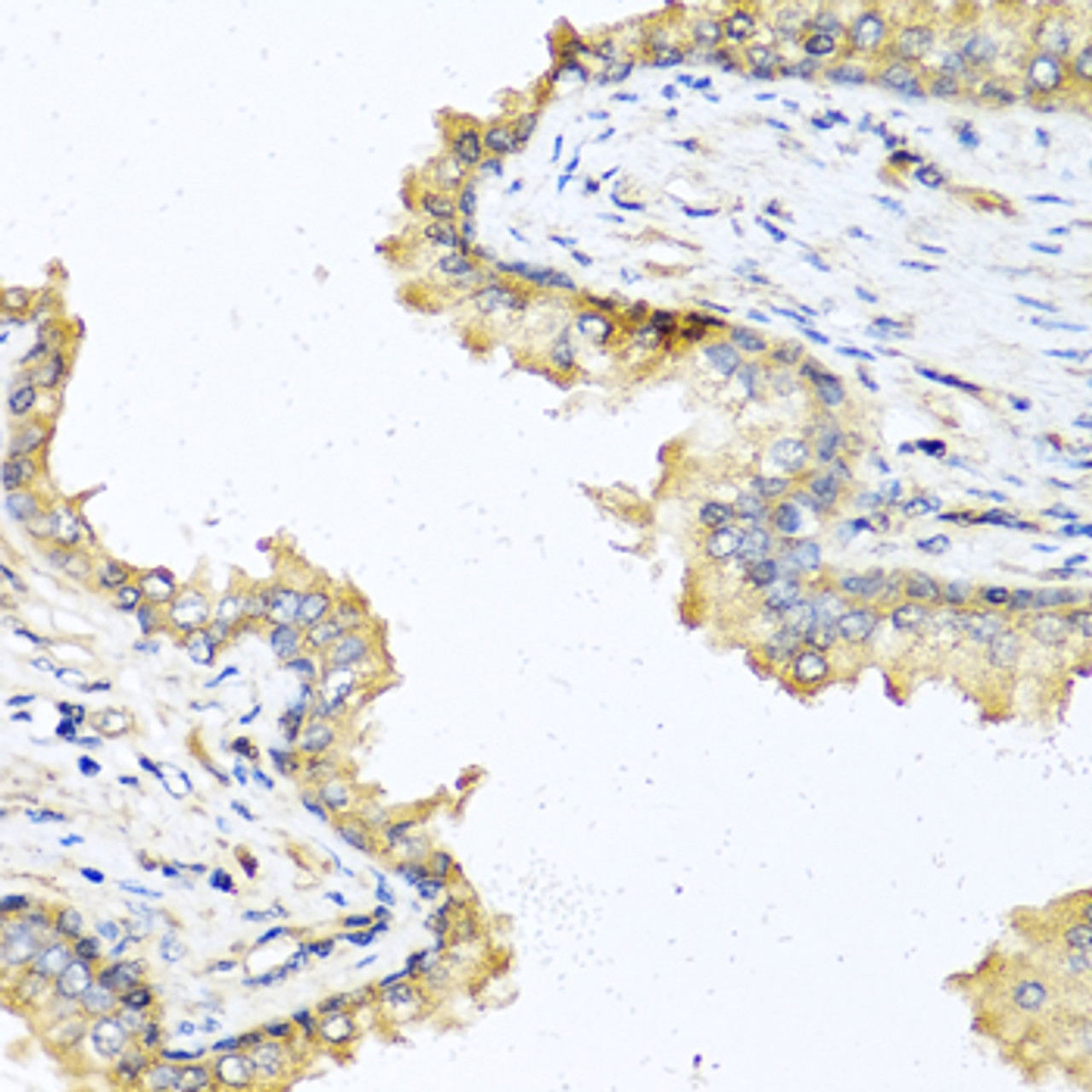 Immunohistochemistry of paraffin-embedded Human prostate using DEFB121 Polyclonal Antibody at dilution of  1:100 (40x lens).