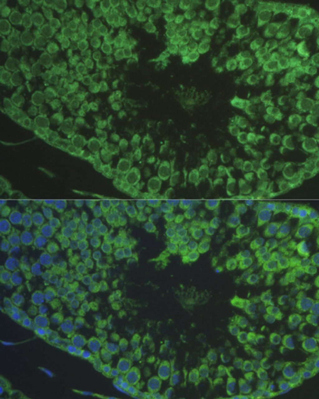 Immunofluorescence analysis of Rat testis cells using DEFB121 Polyclonal Antibody at dilution of  1:100. Blue: DAPI for nuclear staining.